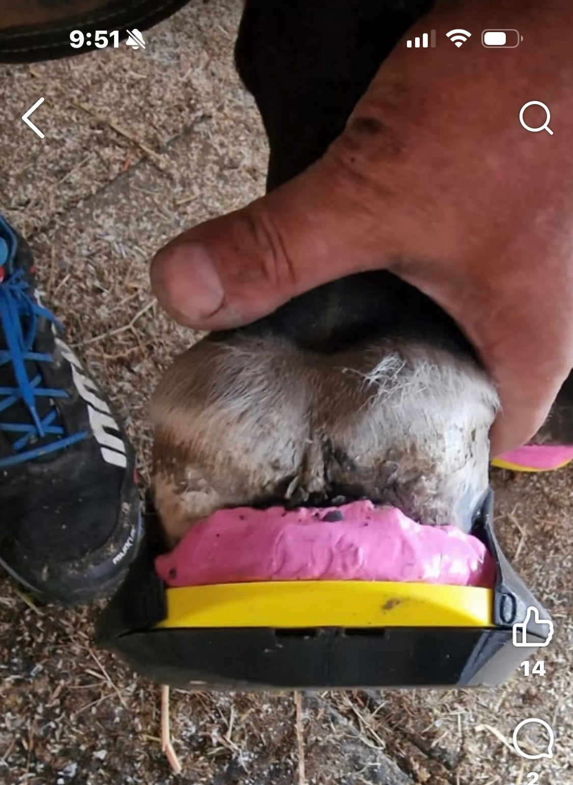 Click in Clog ( comes with 2 casting tape & 12 screws)